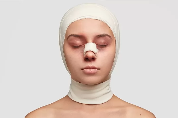 When do swelling and bruising subside after closed rhinoplasty? Detailed recovery guide.